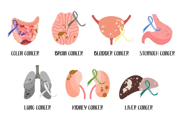 Órgano Humano Interno Colon Cerebro Vejiga Estómago Pulmón Riñón Hígado — Archivo Imágenes Vectoriales