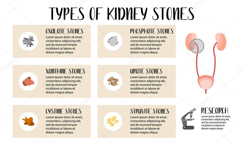 Types of kidneys stones. Oxalate, phosphate, xanthine, urate, cystine, struvite stones. Urolithiasis disease. Kidney and bladder disease. Vector flat illustration. Perfect for flyer, medical brochure