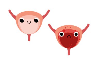 Cute bladders characters with smiling and sad face. Funny kawaii human internal organ with eyes. Healthy and illness insides, bladder disease. Urology. Vector flat cartoon illustration