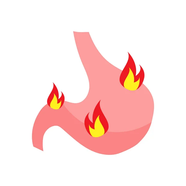 Gyomorégés Gyomorbetegség Belső Szerv Lángokban Áll Gerd Gyomorfekély Savas Reflux — Stock Vector