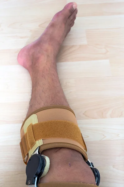 Knee brace support for leg or knee injury — Stock Photo, Image