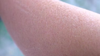 Makro: Büyük ölçüde yetişkin kadın bacak beyaz deri tabakası peeling susuz