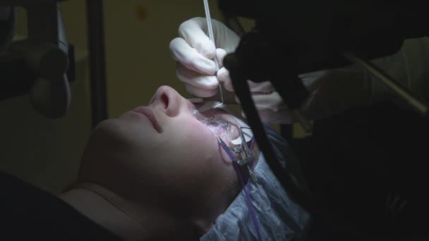 Kirurgen tar bort lasik hornhinnan luckan — Stockvideo