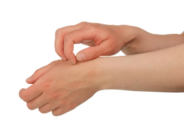 Hands scratching skin — Stock Photo, Image