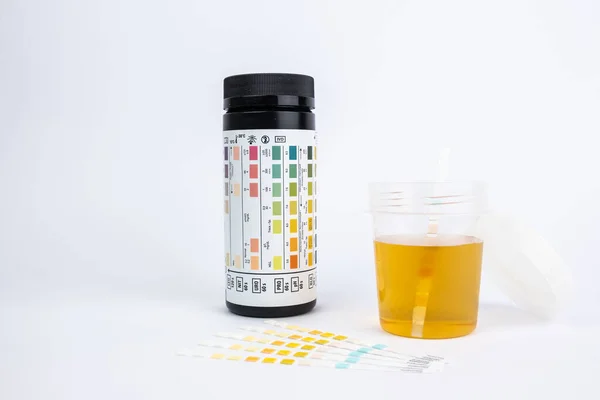 Gros Plan Des Bandelettes Test Une Tasse Pour Analyse Urine — Photo