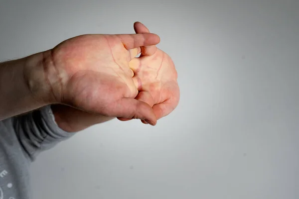 Eine Nahaufnahme Einer Person Die Die Hände Vor Einem Grauen — Stockfoto