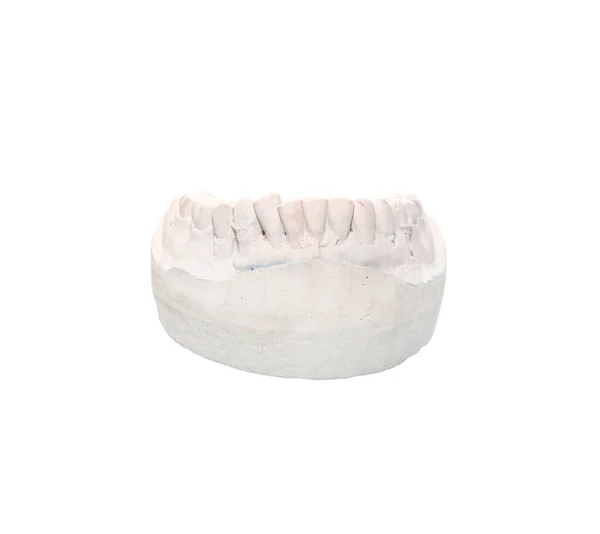 Detailní Záběr Sádrových Modelů Zubů Izolovaných Bílém Pozadí — Stock fotografie