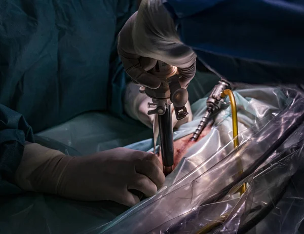 Veterinário Realiza Cirurgia Cão Com Instrumentos Médicos Sala Cirurgia Hospital — Fotografia de Stock