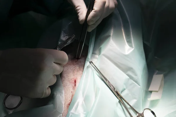 Closeup Shot Surgical Process Pair Hand Operating Surgical Instruments — Fotografia de Stock