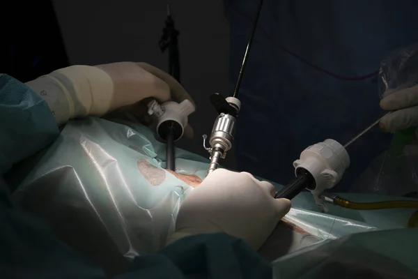 Close Mãos Árvore Com Instrumentos Cirúrgicos Durante Processo Cirúrgico — Fotografia de Stock