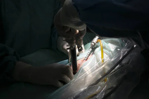 Tiro Perto Das Mãos Com Instrumentos Cirúrgicos Durante Processo Cirúrgico — Fotografia de Stock