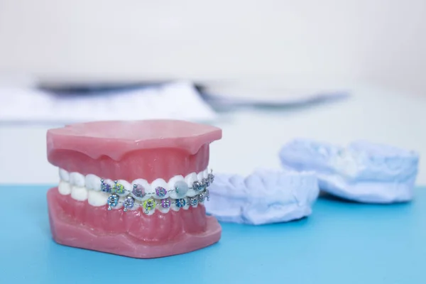Zbliżenie Różnych Zestawów Symulowanych Zębów Niebieskiej Powierzchni — Zdjęcie stockowe