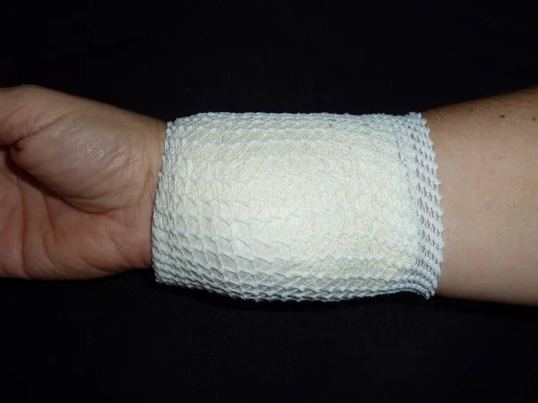 手術後の包帯で人の手を閉じるショット — ストック写真