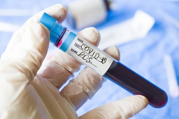 Kan Testinin Yüksek Açılı Görüntüsü Beyaz Eldivenli Bir Doktorun Elinde — Stok fotoğraf