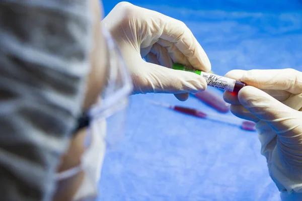 Hiv Pozitif Bir Kan Testi Tüpü Tutan Tıbbi Çalışanların Seçici — Stok fotoğraf