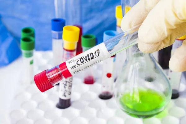 Nahaufnahme Eines Covid Bluttests Der Hand Eines Laborarztes — Stockfoto