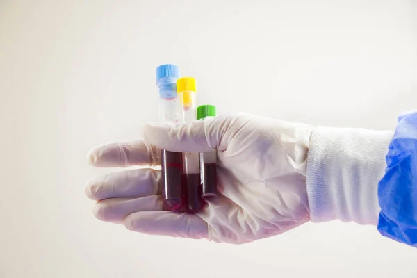 Eldiven Içinde Farklı Test Tüplerindeki Kan Örneklerini Tutarken Çekilmiş Yakın — Stok fotoğraf