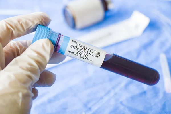 Covid Pozitif Kan Testi Tüpü Tutan Eldivenli Bir Elin Seçici — Stok fotoğraf