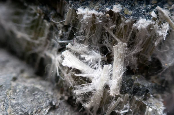 Azbestowe Włókna Chryzotylowe Które Powodują Choroby Płuc Pochp Rak Płuc — Zdjęcie stockowe