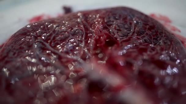 Een Close Van Een Menselijke Placenta Lakens Het Ziekenhuis Geschoten — Stockvideo