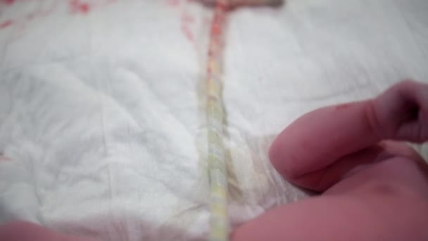 4Kで撮影された病院のベッドシートに人間の胎盤の閉鎖 — ストック動画