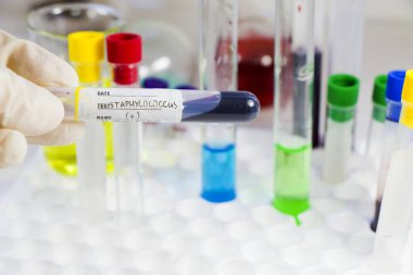 A closeup shot of a positive Staphylococci blood test full tube with other laboratory items in the background clipart