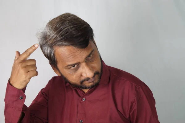 Indický Muž Ukazuje Své Bílé Vlasy Vypadávání Vlasů Problém Mladém — Stock fotografie