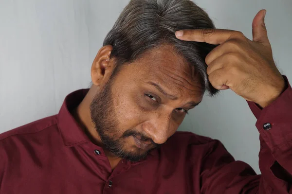 Indický Muž Ukazuje Své Bílé Vlasy Vypadávání Vlasů Problém Mladém — Stock fotografie