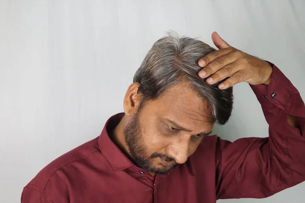 Uomo Indiano Che Mostra Suoi Capelli Bianchi Problemi Perdita Dei — Foto Stock