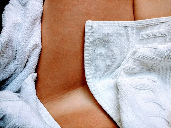 Close Coxas Queimadas Sol Mulher Cobertas Com Uma Toalha Branca — Fotografia de Stock