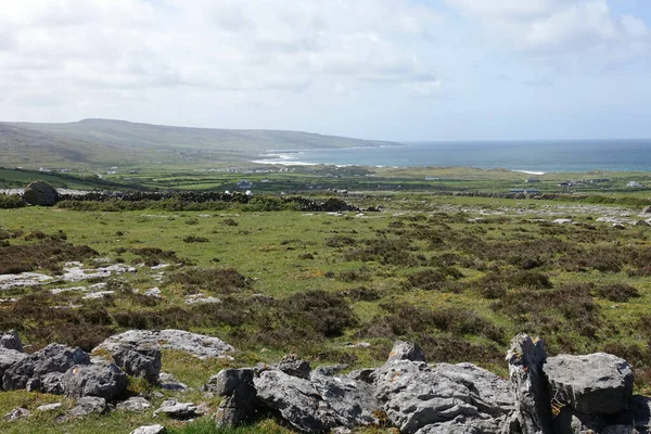 Uma Vista Panorâmica Vales Verdes Exuberantes Irlanda Fundo Azul Céu — Fotografia de Stock