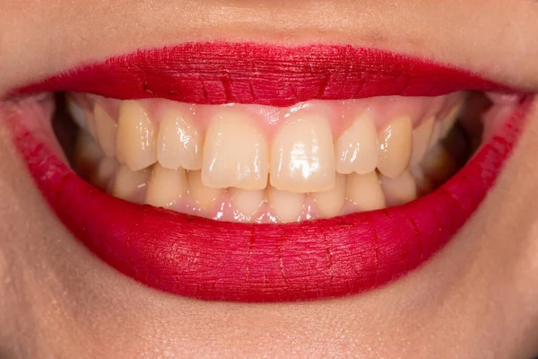 有漂亮牙齿的女性嘴的特写镜头 — 图库照片