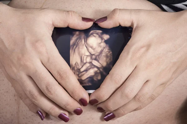 Uma Mãe Segurando Imagem Ultrassonografia Bebê Frente Barriga Criando Uma — Fotografia de Stock