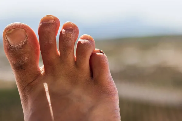 Selektive Fokusaufnahme Eines Fragments Eines Männlichen Fußes Unter Sonneneinstrahlung — Stockfoto