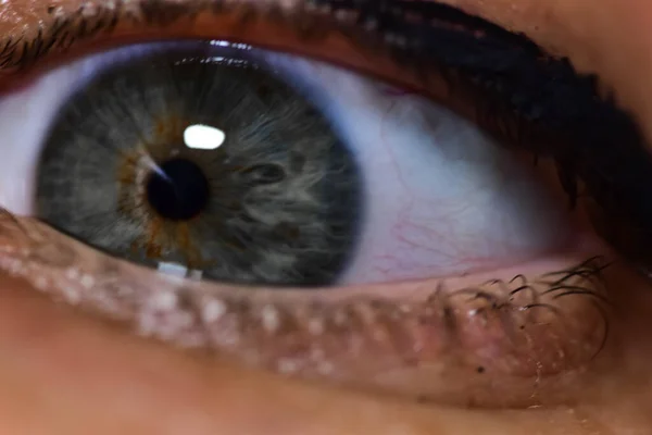 Eine Extreme Nahaufnahme Einer Erweiterten Pupille Eines Auges Ein Verängstigter — Stockfoto