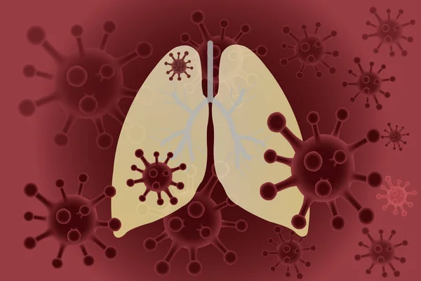 Flat Illustration Human Lungs Coronavirus Disease Bacterias Red Background — Stock Photo, Image