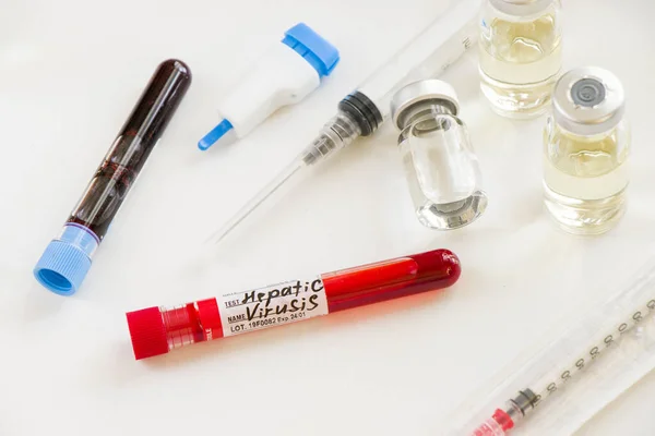 Primer Plano Una Muestra Análisis Sangre Del Virus Hepatitis Una — Foto de Stock