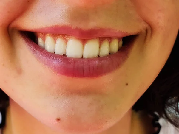 Une Vue Rapprochée Sourire Heureux Avec Des Dents Blanches — Photo