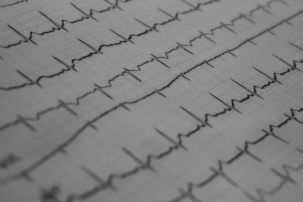 Ekg Lekarza Ekg Von Einem Arzt — Zdjęcie stockowe