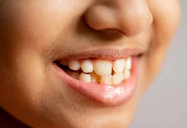 Karachi Paquistão Junho 2021 Uma Parte Rosto Sorridente Com Dentes — Fotografia de Stock