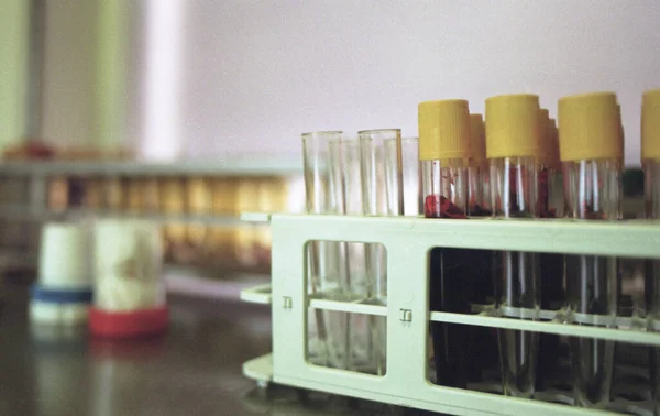 Close Amostras Exames Sangue Recipiente Mesa Laboratório — Fotografia de Stock