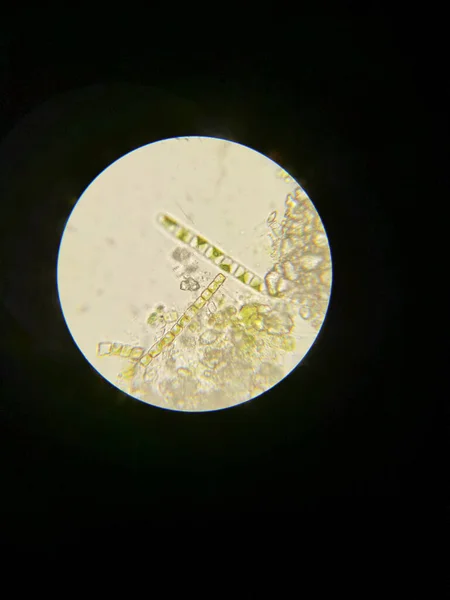 Las Algas Observadas Bajo Microscopio — Foto de Stock