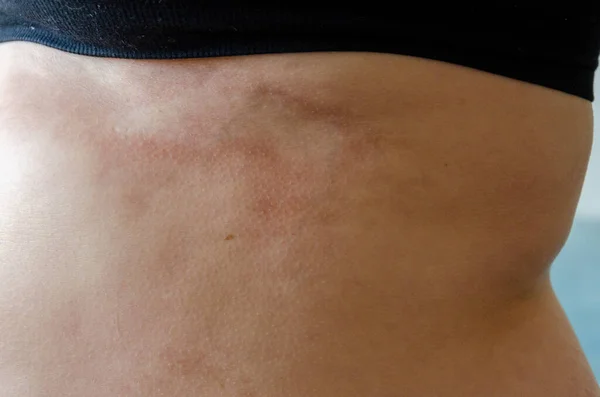 Vertical Shot Female Body Detail Belly Back — Stock Photo, Image