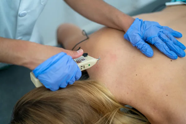 Tiro Perto Médico Colocando Uma Caneta Acupuntura Pele Uma Mulher — Fotografia de Stock