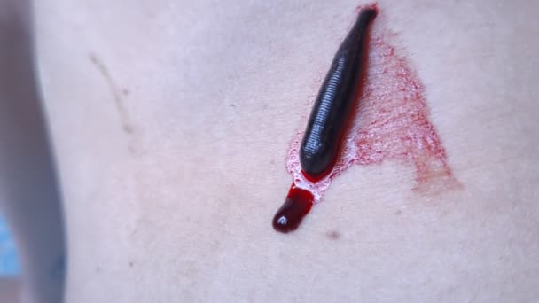 Sanguessuga Pele Humana Vista Perto — Vídeo de Stock