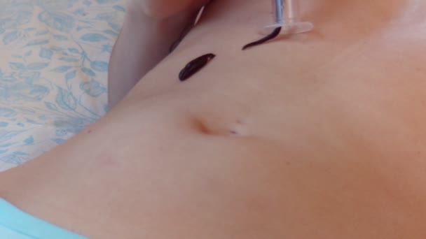 Mão Feminina Colocando Sanguessuga Pele Vista Perto — Vídeo de Stock