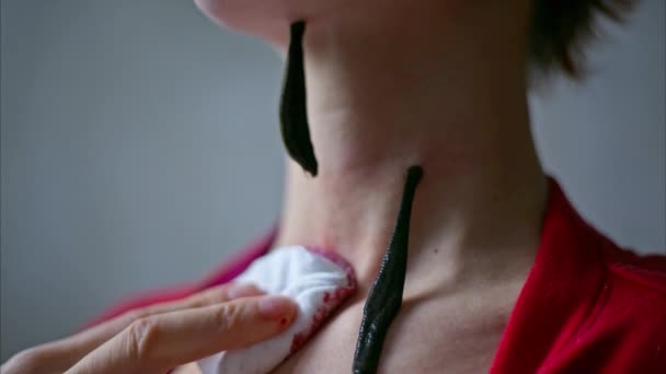 Vrouwelijke Hand Leggen Bloedzuigers Huid Van Dichtbij Bekijken — Stockvideo