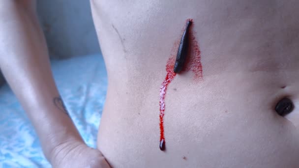 Blutegel Auf Der Menschlichen Haut Nahsicht — Stockvideo