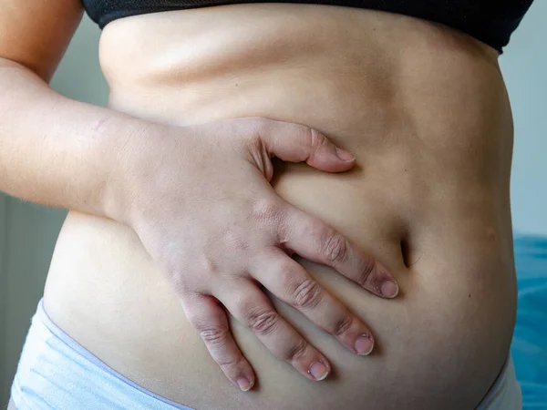 Una Vista Cerca Una Mujer Sosteniendo Estómago Mostrando Celulitis Ropa —  Fotos de Stock