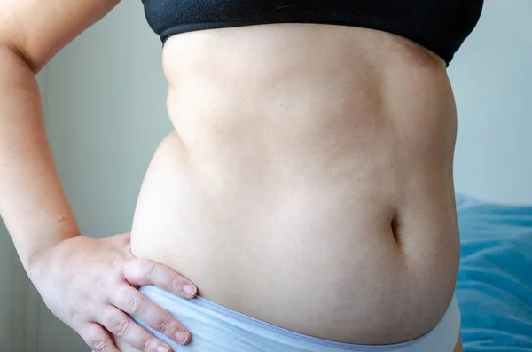 Torse Une Femme Courbée Positivité Corps — Photo